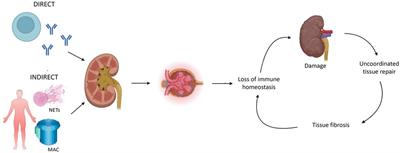 Editorial: Optimizing outcomes for children with immune-mediated chronic kidney disease